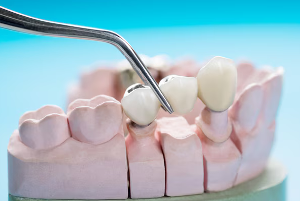 Revitalize Your Smile with Custom-Made Restorative Dental Crowns Protect and Enhance Your Teeth