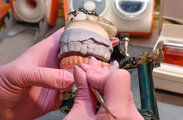 Full Mouth Reconstruction for Complete Smile Restoration