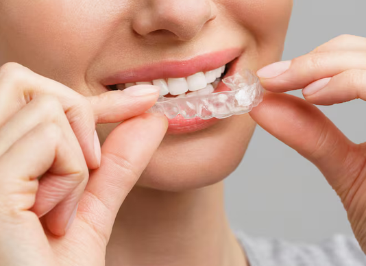 Straightening Teeth Discreetly: A Grown-Up's Guide to Clear Trays